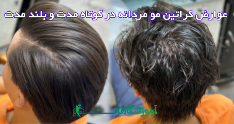عوارض کراتین مو مردانه